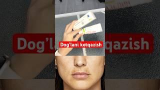 Dog’lani oqartirish eng zo’r usuli #skincare #botox #skincareroutine #botoxcosmetic #duet