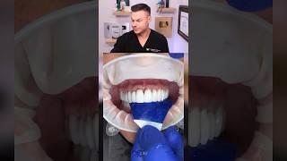 Dentist Reveals Surprising Top Reason For TOOTH Pain! 