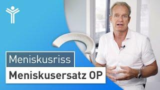 Meniskusersatz OP: Ersatz des Meniskus durch Implantat oder Transplantation