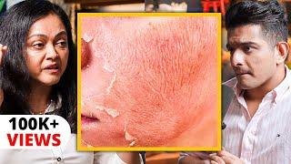 CELEBRITY SKIN CARE Secret - "Skin Peels" Explained By Bollywood's Dermat Dr.Rashmi