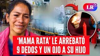 Madre de NIÑO que PERDIÓ 9 DEDOS y un OJO tras manipular una 'MAMA RATA' pide ayuda | #LR