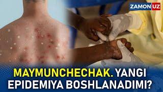 MAYMUNCHECHAK. YANGI EPIDEMIYA BOSHLANADIMI?