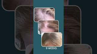 Hair happiness starts with Happy Head!