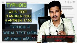 TYPHOID ; CAUSE AND TREATMENT IN EASY WAY / Dr. CHANDRASHEKHAR VERMA MBBS