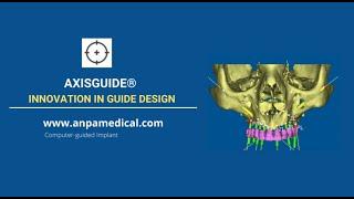 AxisGuide®  Innovation in guide design.