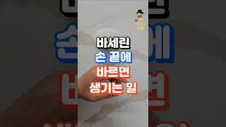 손 끝에 바세린 바르면 생기는 일, 손가락 찌릿,저리는 분들 #건강정보 #건강한중년 #중년건강 #건강상식 #건강관리 #지식 #건강 #장수의비밀