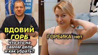 Вдовий Горб️Что Это На Самом Деле? Как убрать холку #холка #вдовийгорб