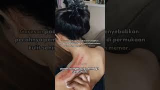 Kerokan wanita #pijat #kerokan #kerokanwanita #kerokanmasukangin