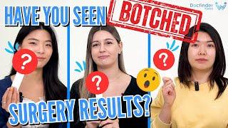 Have you seen Botched Surgery results?  Docfinderkorea QnA | Plastic Surgery in Korea. Part 1