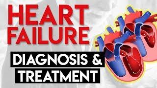 Diagnosis and Treatment | Heart Failure (Part 4)