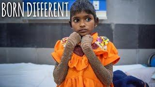 The Girl Who Is Turning To Stone | BORN DIFFERENT