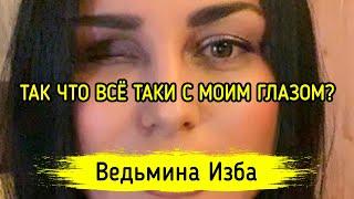 ТАК ЧТО ВСЁ ТАКИ С МОИМ ГЛАЗОМ? ВЕДЬМИНА ИЗБА ▶️ ИНГА ХОСРОЕВА