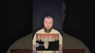 О важности фотографии в стоматологии. Рассказать подробнее? #виниры #dentist #стоматология