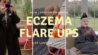 DO YOU HAVE ECZEMA? YOU NEED TO WATCH How I Manage/Prevent Flare Ups | Family Day At The Ritz London