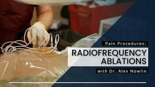 Radiofrequency Ablations: What You Should Know