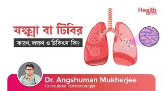 যক্ষ্মা বা টিবি রোগের কারণ, লক্ষণ ও চিকিৎসা কি? | Tuberculosis:Causes, Symptoms & Treatment