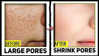 Shrink Your Open And Large pores With This Face Toner | Drx Reviews