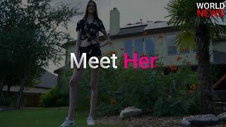 Meet 17 year old girl who has the world's longest legs