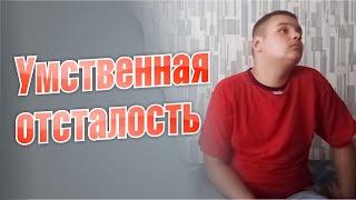 Умственная отсталость. Был абсолютно здоровым