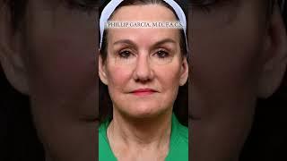 Plastic Surgery Stigma