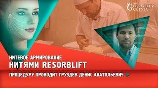 Нитевой лифтинг нитями RESORBLIFT. Процедуру проводит Груздев Денис Анатольевич