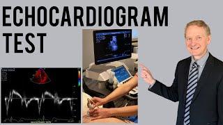 Echocardiogram Procedure | Heart Ultrasound | Everything you need to know