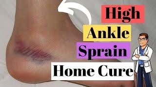 High Ankle Sprain Treatment [Causes & Best Recovery Time!]