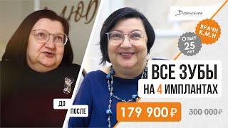 Имплантация зубов  Видео отзыв, All on 4 альтернатива, замена всех зубов до/после.