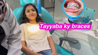 Tayyaba ky braces lgwany gai | good news mili | Sitara yaseen family vlog
