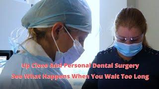 For Patients; Step By Step Dental Extraction And Bone Graft, Invisalign, Dental Implants.