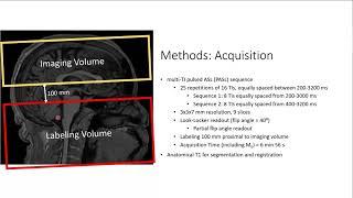 Detectability of WM perfusion across flow territories using ASL: Impact of Hct and BAT