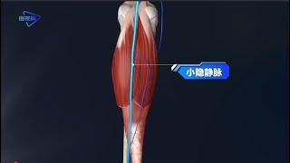 3D【Human anatomy】-the course of the small saphenous vein/【人体解剖】--小隐静脉的走行