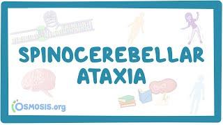 Spinocerebellar ataxia - causes, symptoms, diagnosis, treatment, pathology