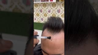 Frontline hair patch. Hair patch for men. Hair patch in Kolkata.best hair patch centre in Kolkata