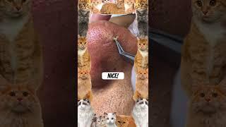 Wow! #pimple #pimplepopper #pimples #shortsfeed #shortvideo #shorts #short #youtubeshorts #youtube