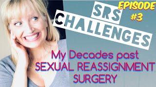 SRS CHALLENGES DECADES LATER Episode #3 | Transgender MTF Transition Post Op Education