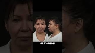 Это точно один человек? Фейслифтинг. Доктор АЛЬТАХХАН