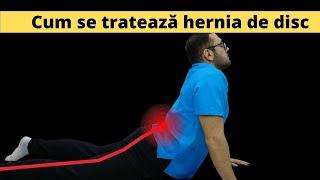 Cum se tratează hernia de disc lombară prin kinetoterapie