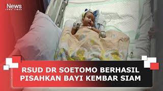 RSUD DR SOETOMO BERHASIL PISAHKAN BAYI KEMBAR SIAM