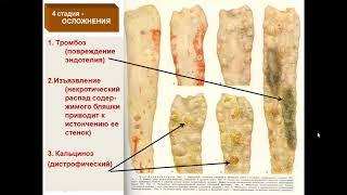 Распространенные заболевания обмена веществ