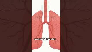 COPD or Asthma? Learn the Critical Differences  #j2healthup #facts #support #copd #asthmacontrol