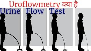 Uroflowmetry test in Hindi | urine flow test explained | Uroflowmetry test kaise hota hai