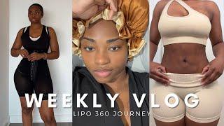 LIPO 360 RECOVERY | SHE GAVE ME FIBROSIS! + Feeling Discouraged + Stage Two Faja Try-On