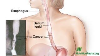 Strawberries versus Esophageal Cancer