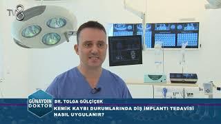 DİŞ İMPLANTI KİMLERE UYGULANIR? DR. TOLGA GÜLCİCEK