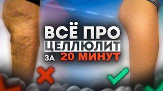 Всё про ЦЕЛЛЮЛИТ за 20 МИНУТ | Причины возникновения и методы борьбы, которые РЕАЛЬНО работают