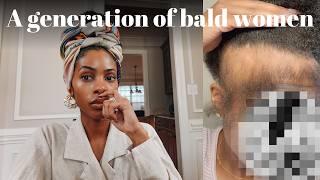 We Are Raising A Generation of Bald Women - Weaves, Wigs, Self Love