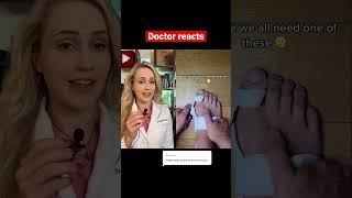 Foot doctor reacts: bunion corrector