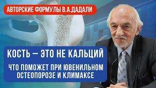 Эти напитки провоцируют ювенильный остеопороз. Профилактика остеопороза при климаксе.