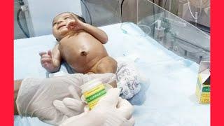 Neonatal baby in abdominal pain to start depository are baby is hungry in baby crayy
